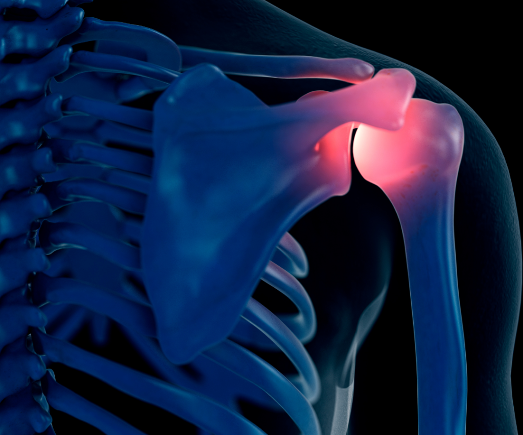 shoulder stock- canva