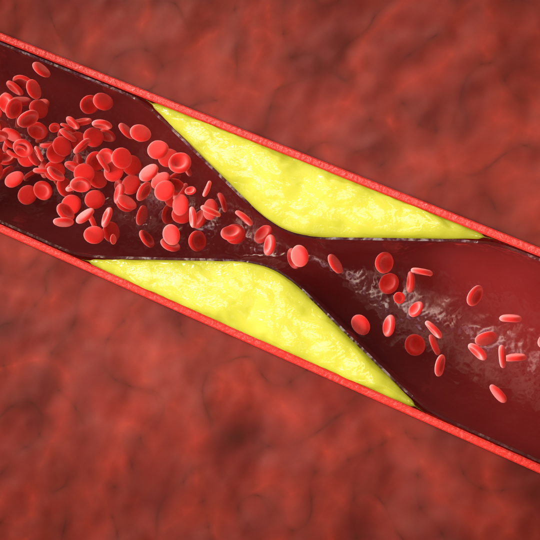 high cholesterol canva stock